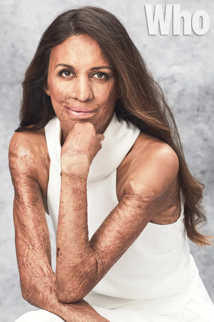 Turia Pitt
