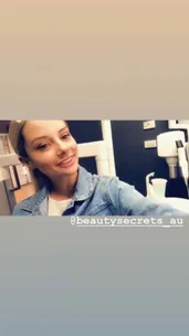 Married At First Sight star Jessika Power REMOVES her lip filler