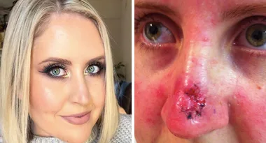 GRAPHIC CONTENT: Married At First Sight’s Lauren reveals cancer scare