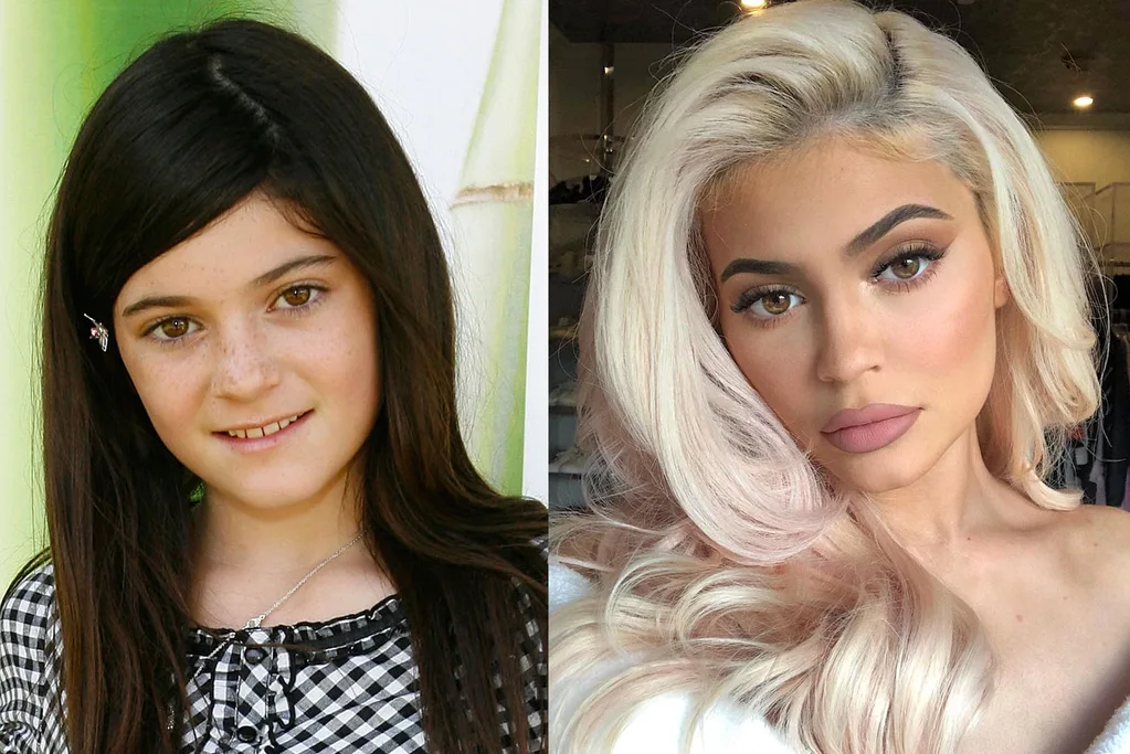 Kylie Jenner before and after photo - 2008 vs 2018