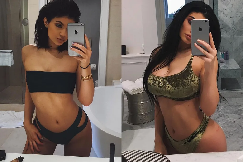 Kylie Jenner before and after photo - 2016 vs 2017