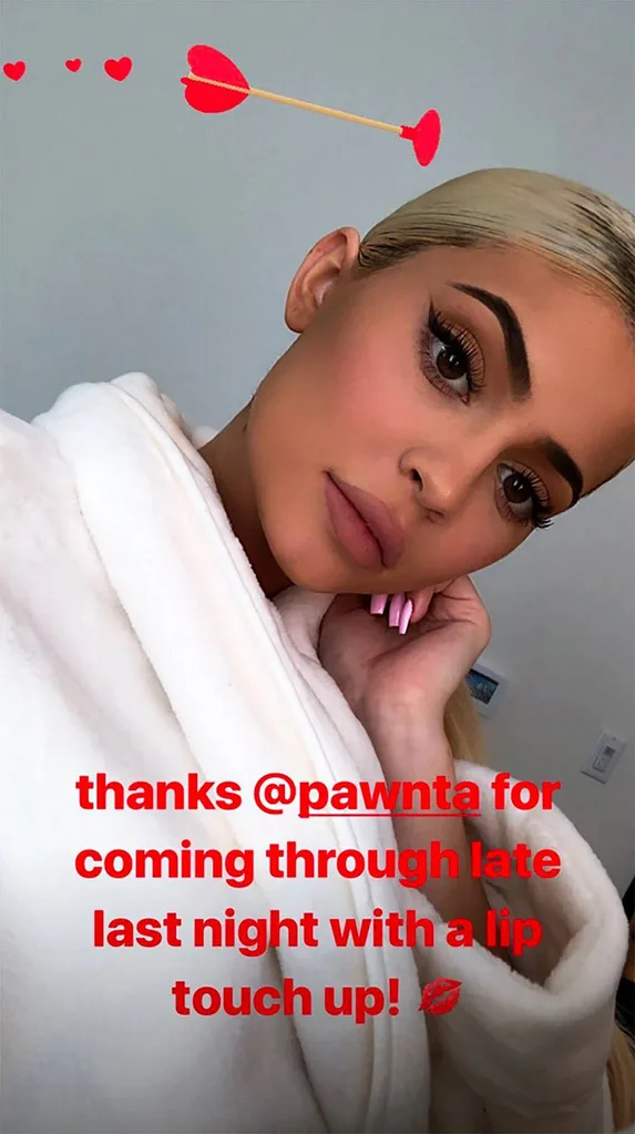 Kylie Jenner Lip Fillers