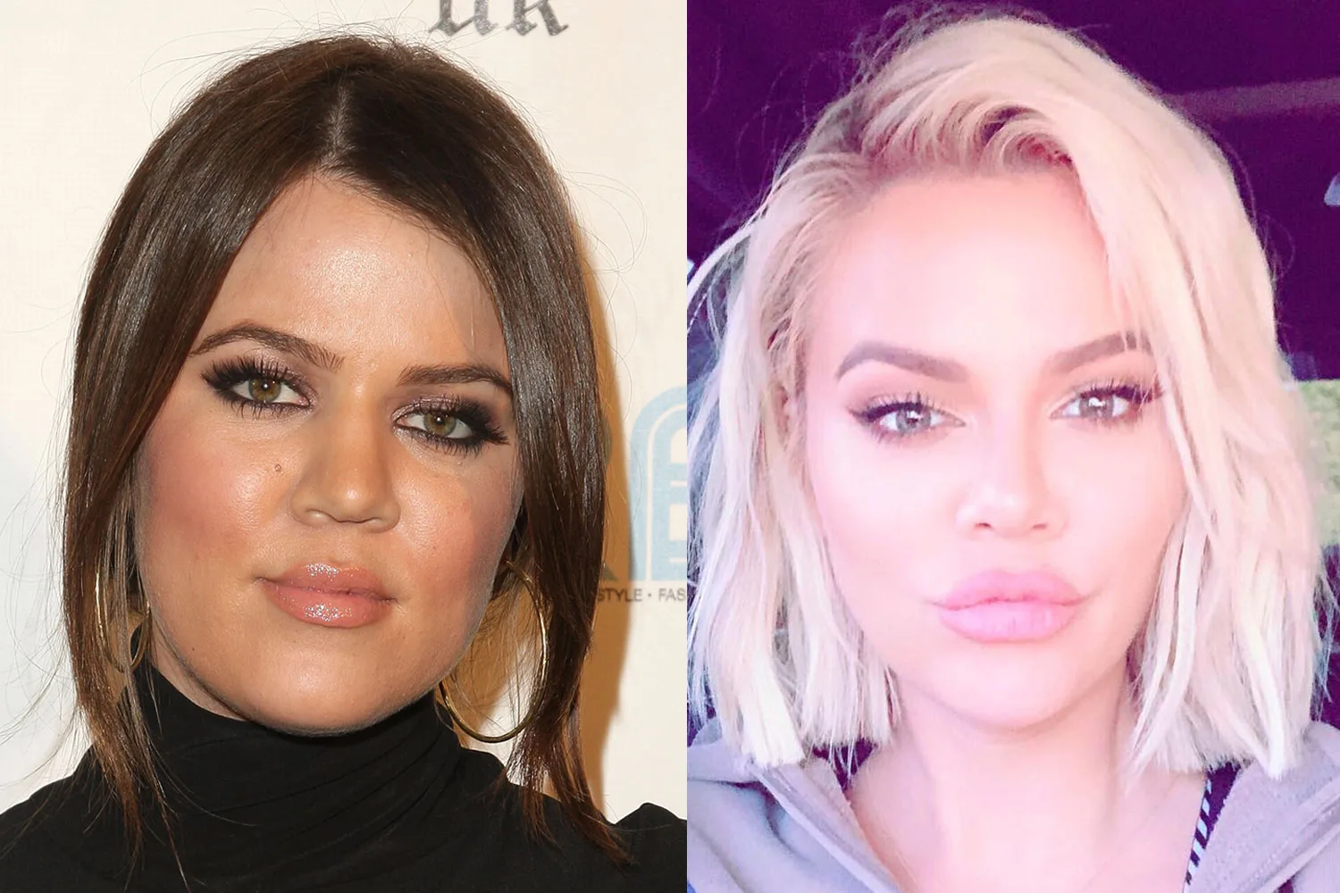Khloe Kardashian Before & After 2008 vs 2019