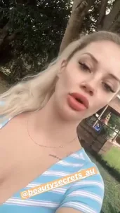 MAFS star Jessika Power sets the record straight on her lips