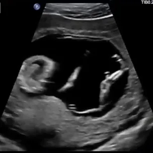 Kris Smith expecting baby number two