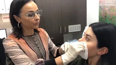 Martha Kalifatidis dissolves her lip filler after botched job