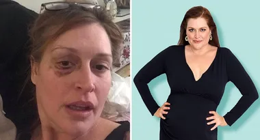 Fears for Tziporah Malkah after she showcases her black eye on social media