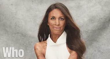 EXCLUSIVE: Turia Pitt opens up about her pregnancy, marriage and overcoming adveristy