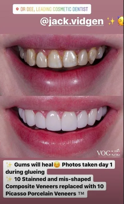 Jack's drastic dental transformation