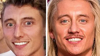 Bachelorette’s Ciarran reveals he had a nose job