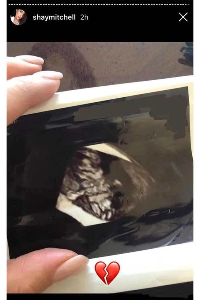 shaymitchellmiscarriage