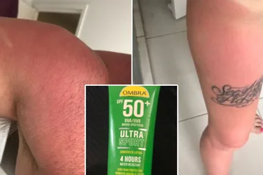 ALDI Ombra sunscreen slammed as acid by users