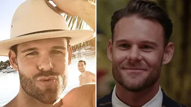 Bachelorette’s Carlin Sterritt admits to getting lip fillers