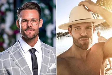 Bachelorette star Carlin admits to getting lip fillers