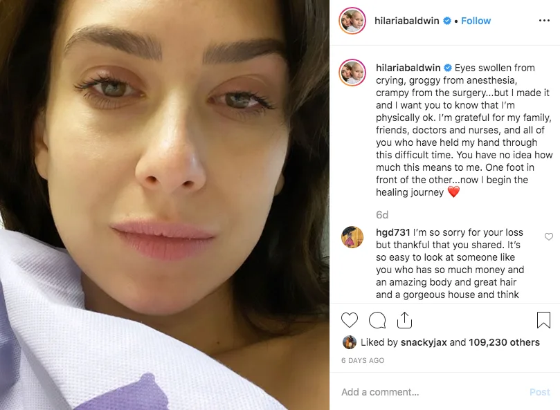 hilaria-baldwin