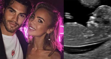 Love Island’s Justin Lacko expecting his first child with girlfriend