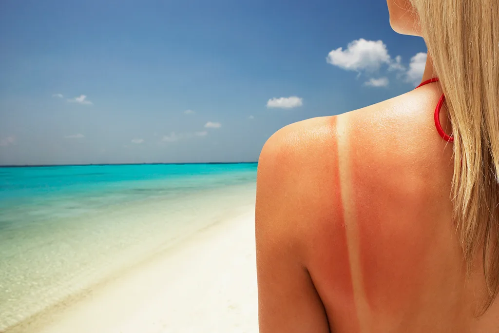 aloe vera benefit 3