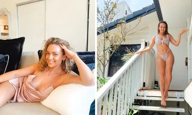 Abbie Chatfield shuts down rife speculation she’s had Botox