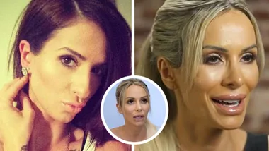 MAFS’ Stacey reveals all the cosmetic surgeries she’s undergone