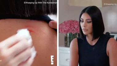 Kim is bleeding in the aftermath of fight with sister Kourtney