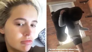Molly Mae says Tommy Fury ‘broke her nose’ by throwing bear at her