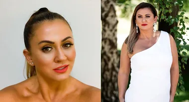 MAFS’ Mishel spills on her plastic surgery procedures
