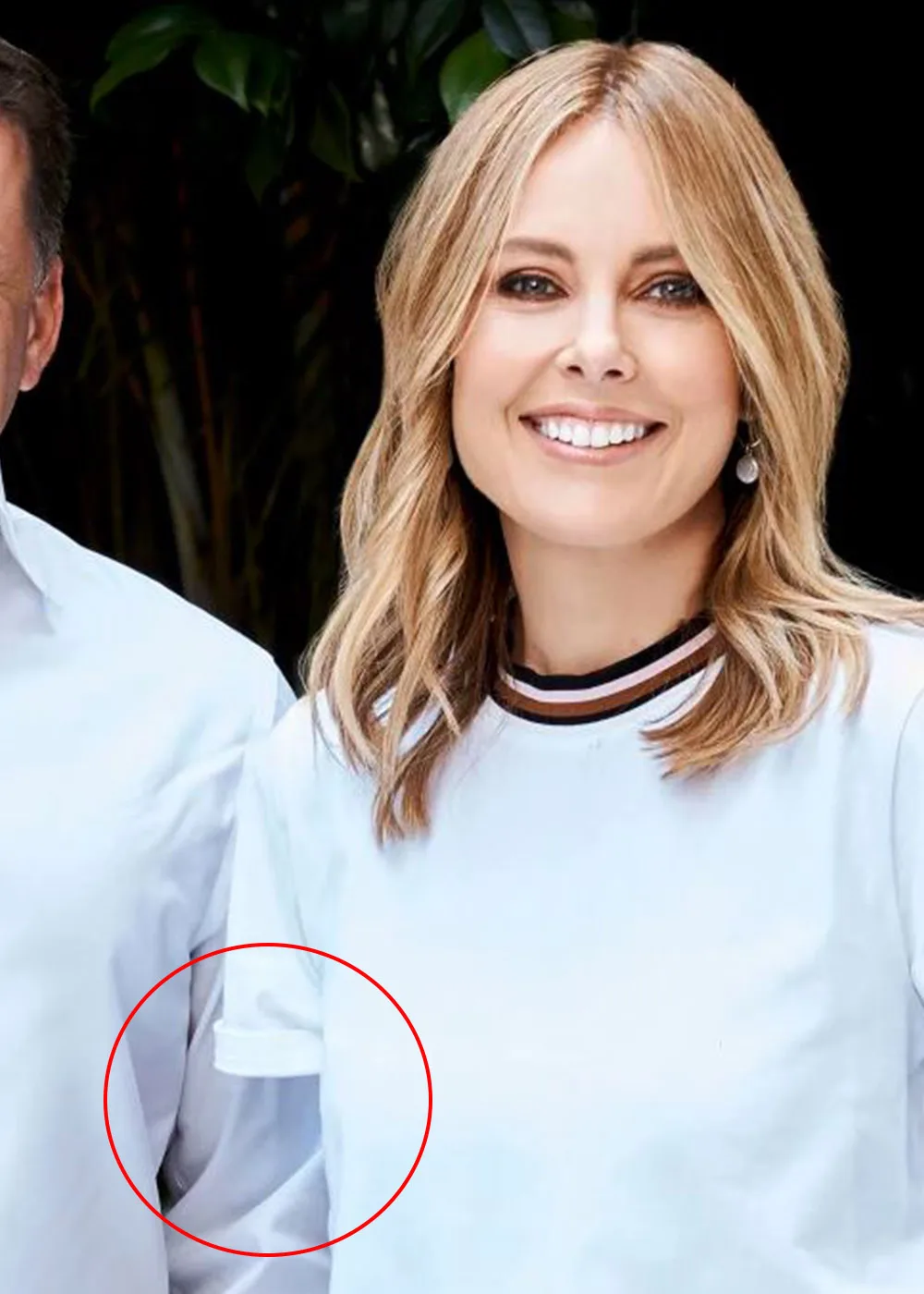 Ally arm