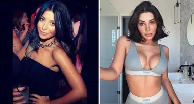MAFS’ Martha Kalifatidis’ plastic surgery transformation