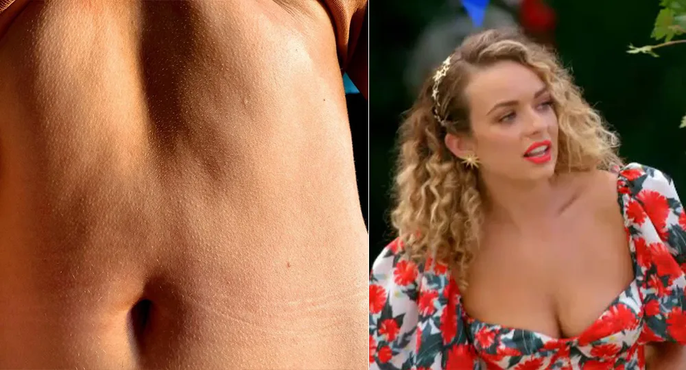 Abbie stomach