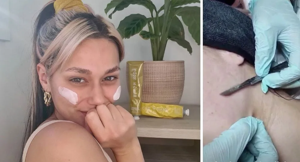 MAFS’ Connie reveals dramatic face treatment