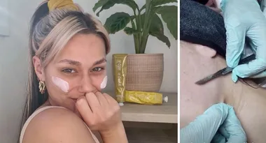 MAFS’ Connie reveals dramatic face treatment