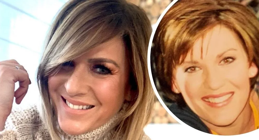 Kylie Gillies’ plastic surgery confession