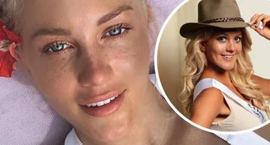 Before And After: Ali Oetjen’s Plastic Surgery Transformation
