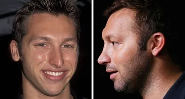 Did Ian Thorpe get a nose job?