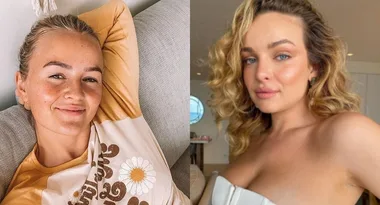 Abbie Chatfield slams Elly Miles over “toxic” veggies post