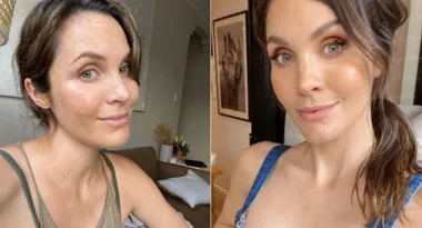 Laura Byrne’s refreshingly candid Botox confession