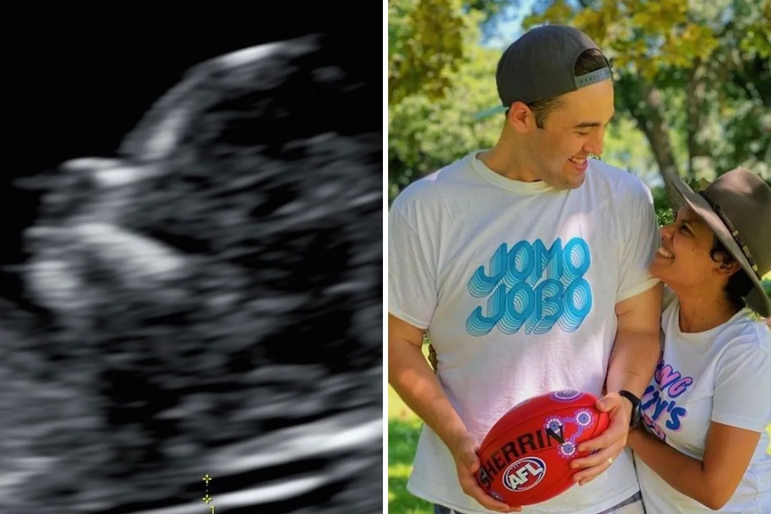 miranda-tapsell-pregnancy-announcement
