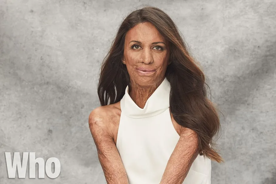 turia pitt