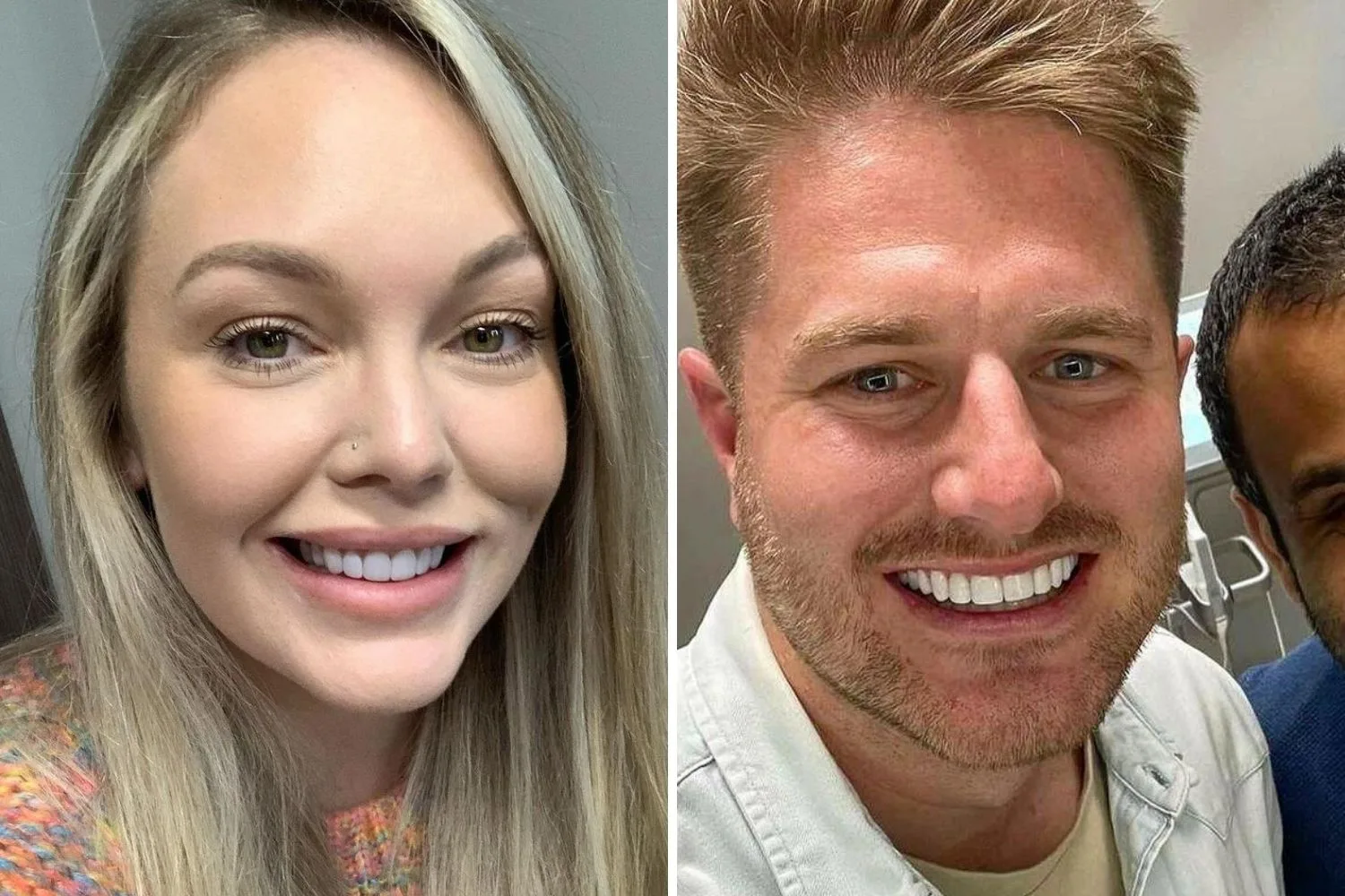 bryce-melissa-teeth-transformation