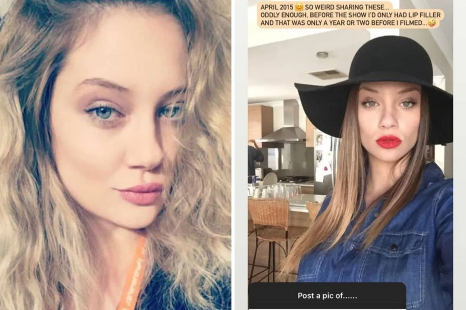 jessika-power-before-cosmetic-surgery