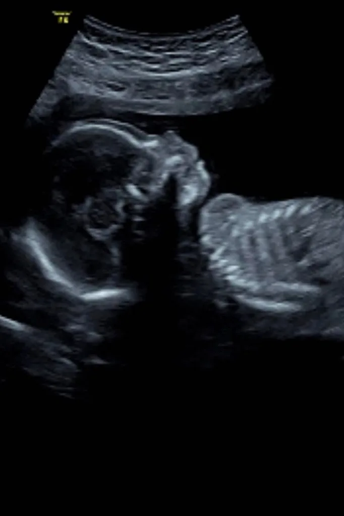 nick cummins baby
