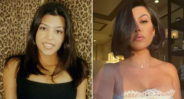 Did Kourtney Kardashian get plastic surgery before her wedding?