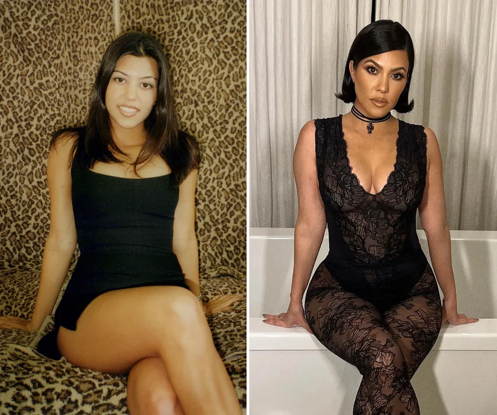 kourtney-before-after-boobs