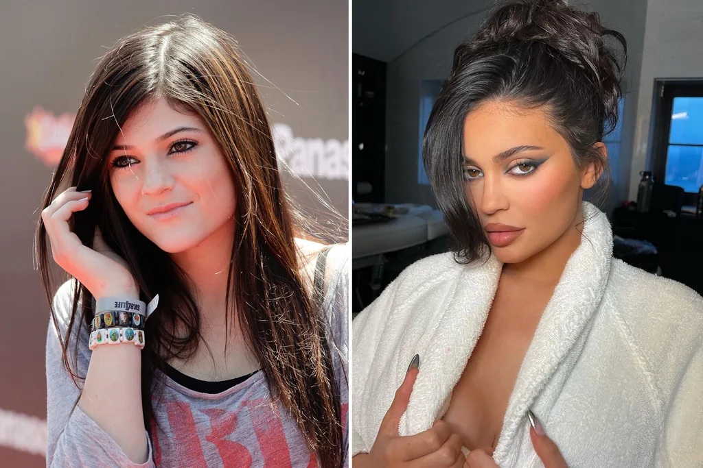kylie-jenner-before-after