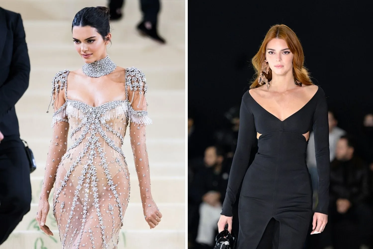 kendall-jenner-before-after
