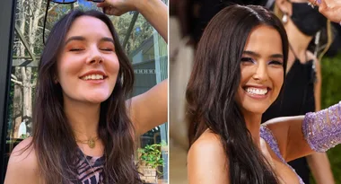 Can $100 teeth whitening give you a celebrity smile?