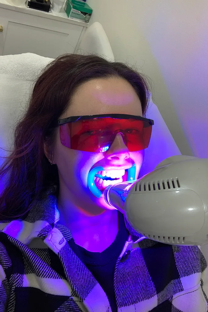 teeth-whitening