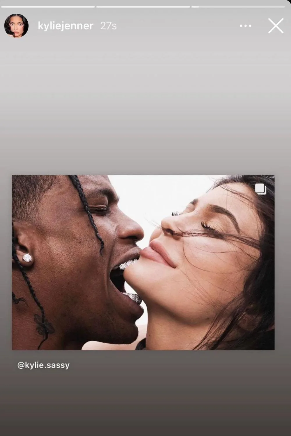 kylie-travis