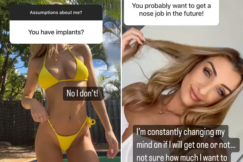 tamara-plastic-surgery