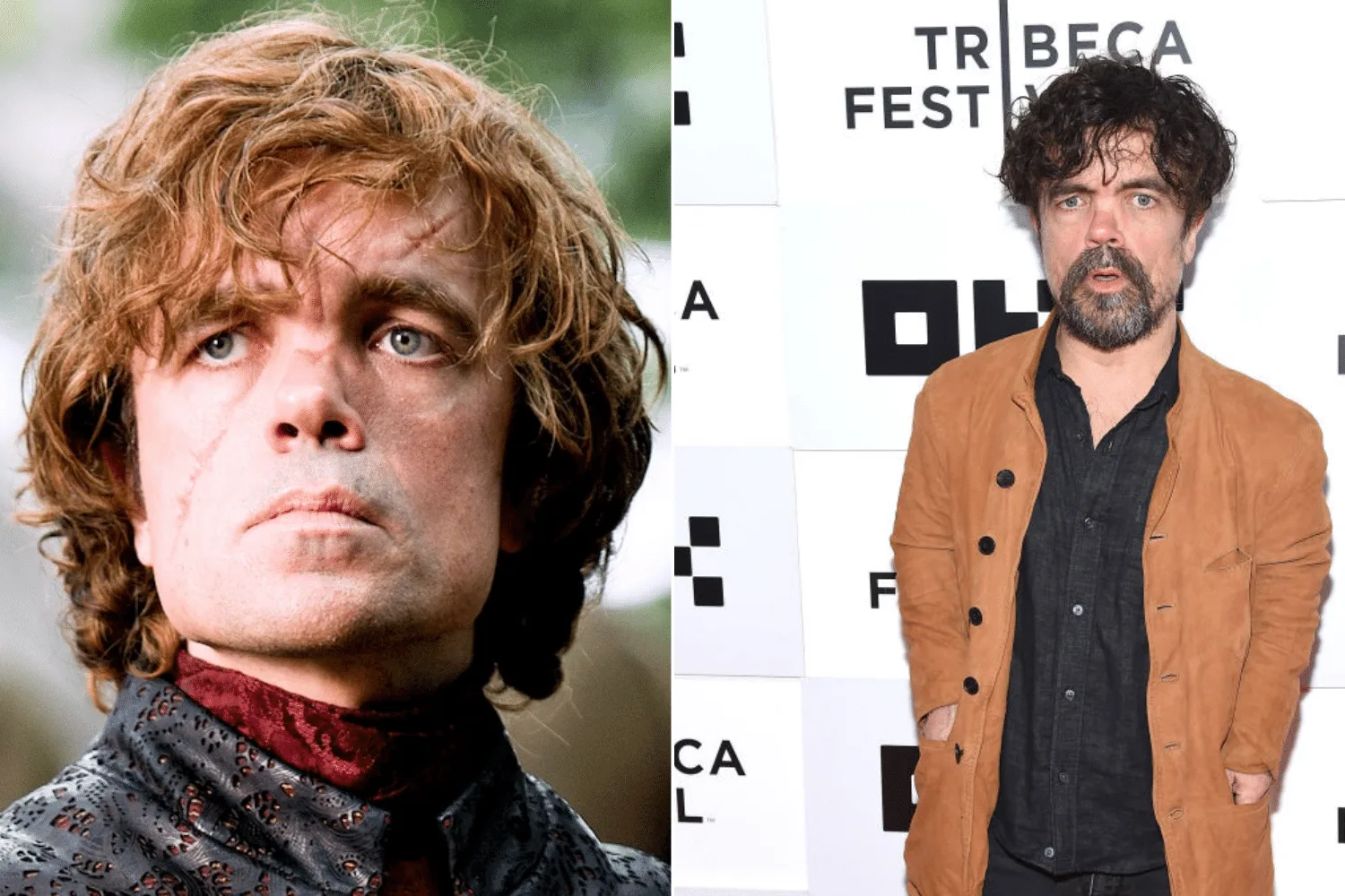 Peter Dinklage
